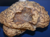 Brain Of a Man